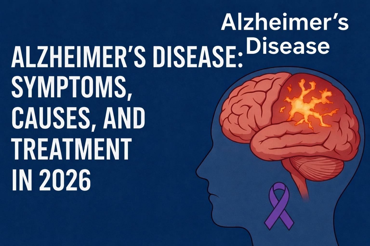 Alzheimer